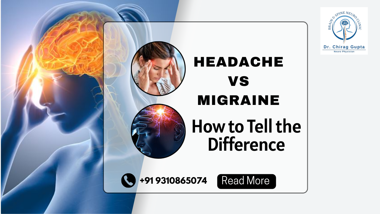 Headache vs Migraine: How to Tell the Difference
